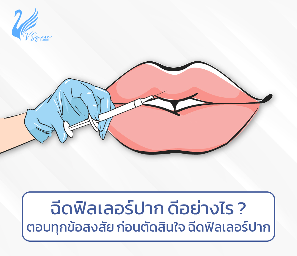 การฉีดฟิลเลอร์ปาก