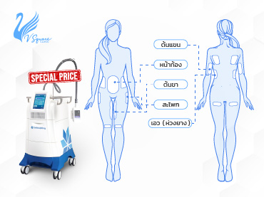 Coolsculpting-ราคา