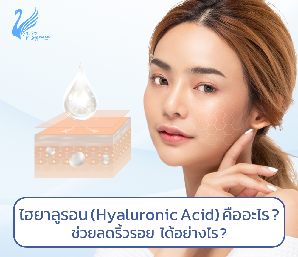 กรดไฮยาลูรอนิค Hyaluronic Acid