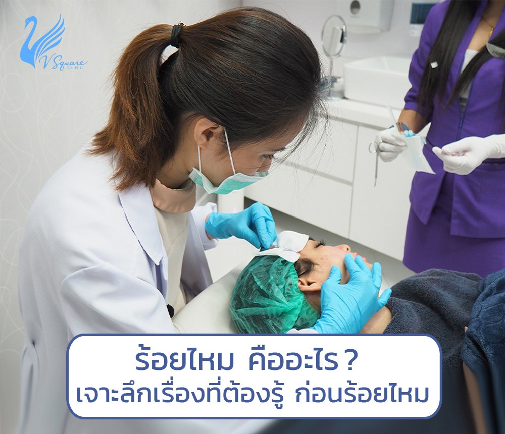 ร้อยไหม-คืออะไร หมอซี