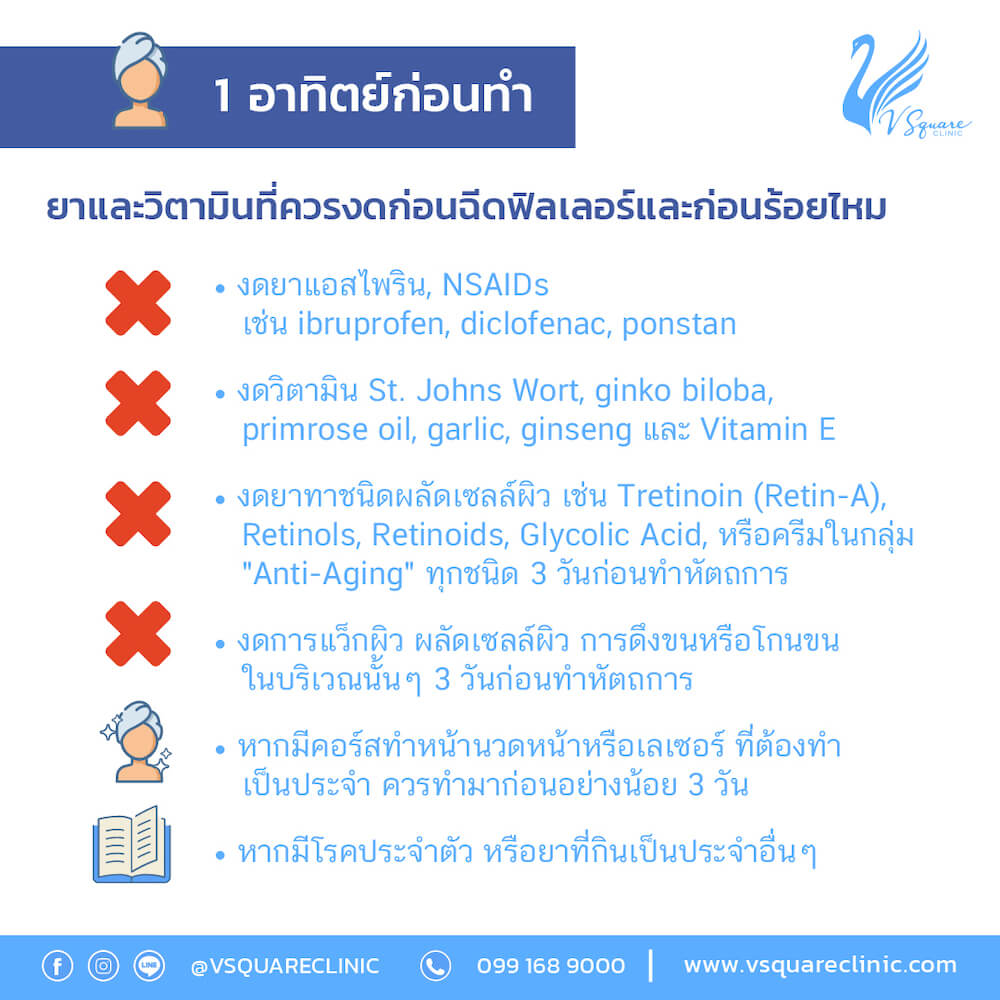 ข้อปฎิบัติก่อนฉีดฟิลเลอร์จมูก