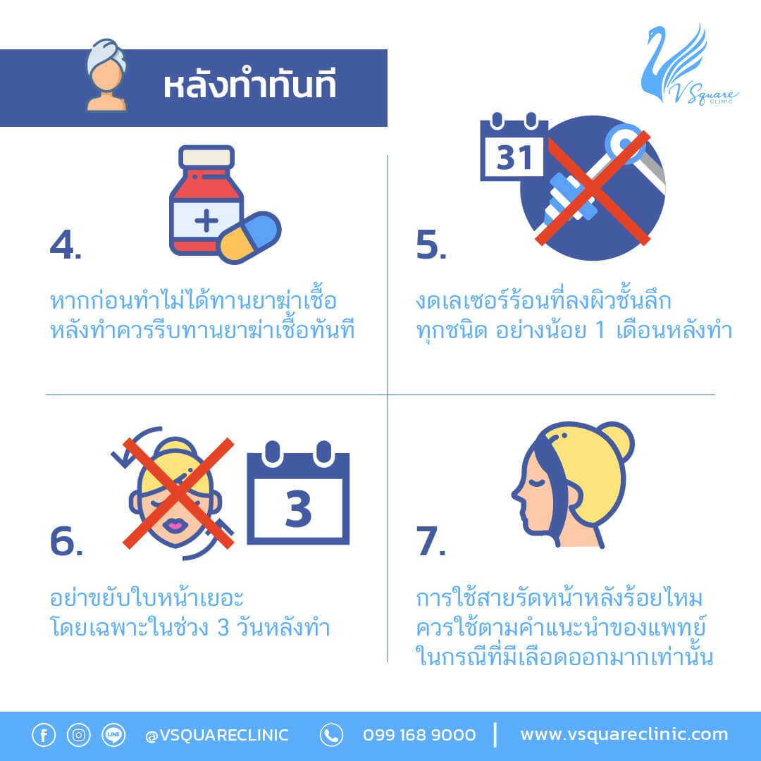 ข้อปฏิบัติตัวหลังฉีดฟิลเลอร์จมูก (3)