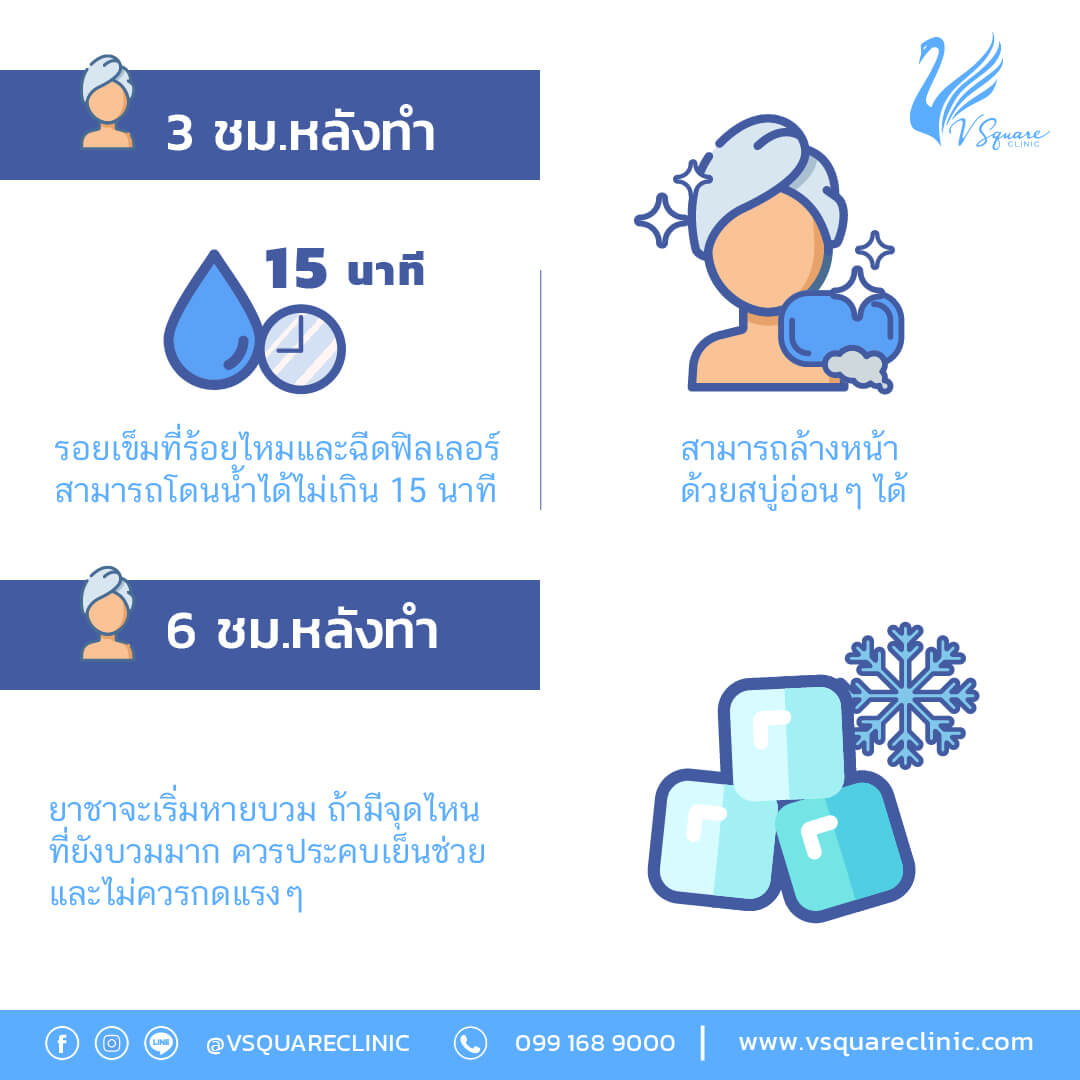 ข้อปฏิบัติตัวหลังฉีดฟิลเลอร์จมูก (4)
