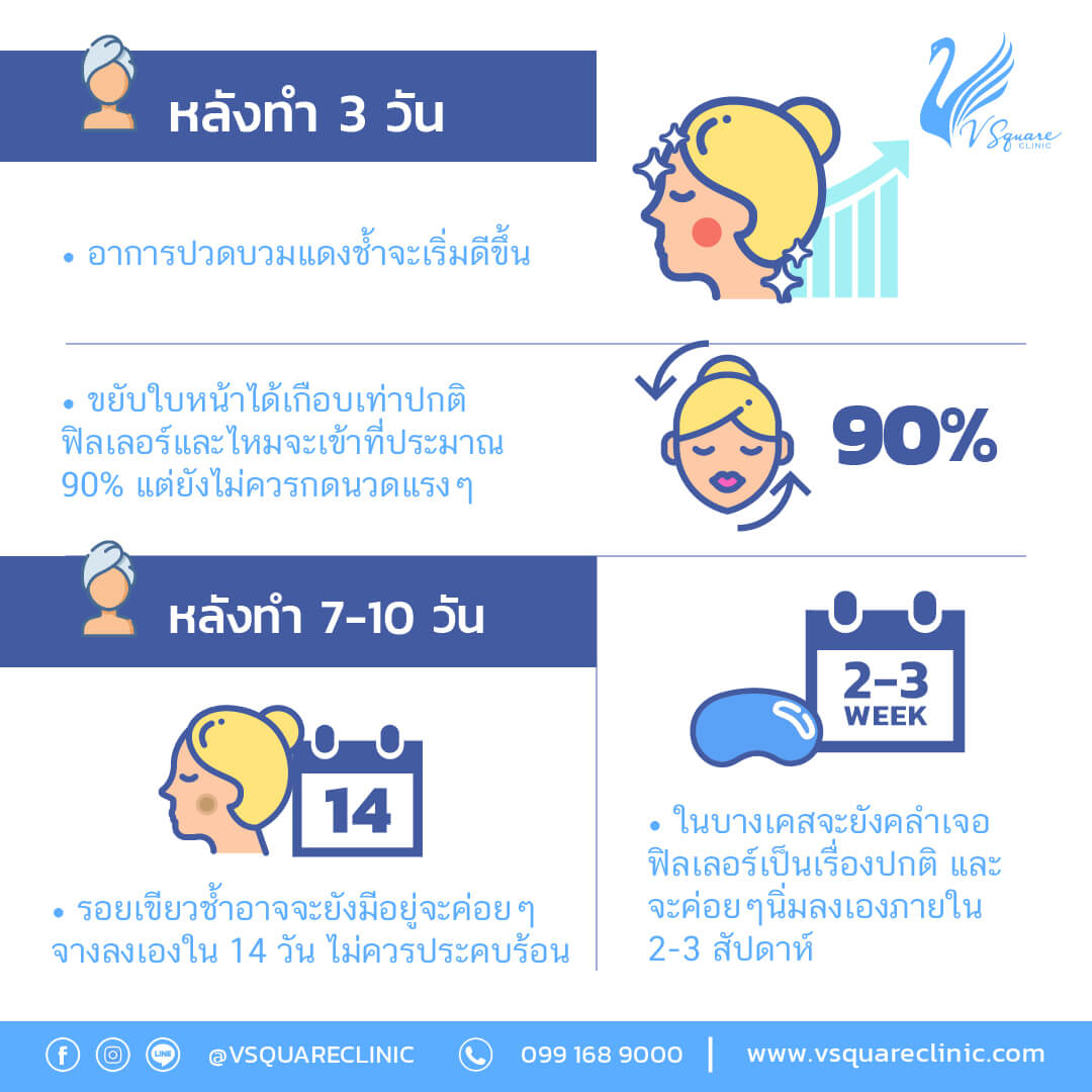 ข้อปฏิบัติตัวหลังฉีดฟิลเลอร์จมูก