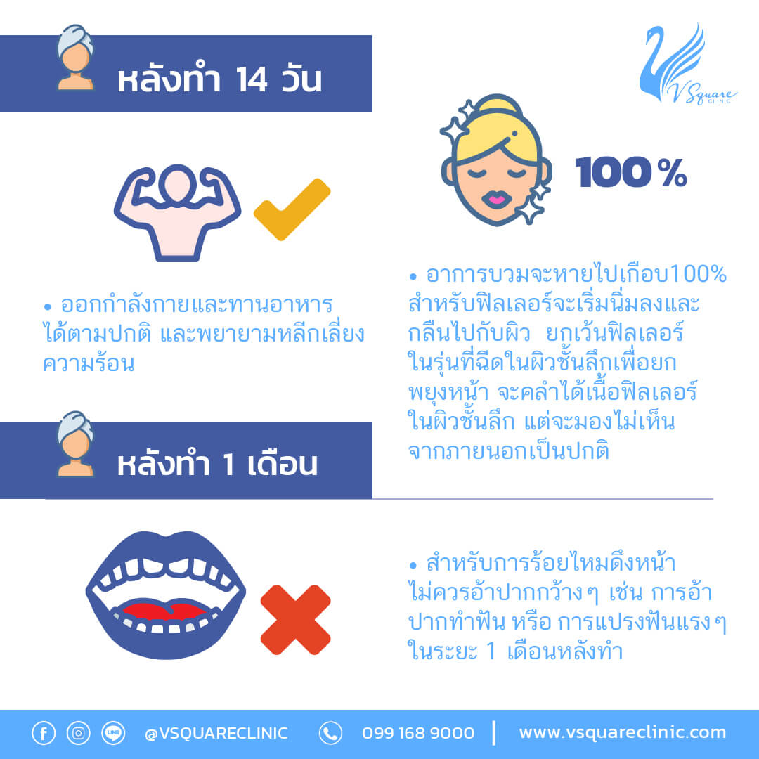ข้อปฏิบัติตัวหลังฉีดฟิลเลอร์จมูก