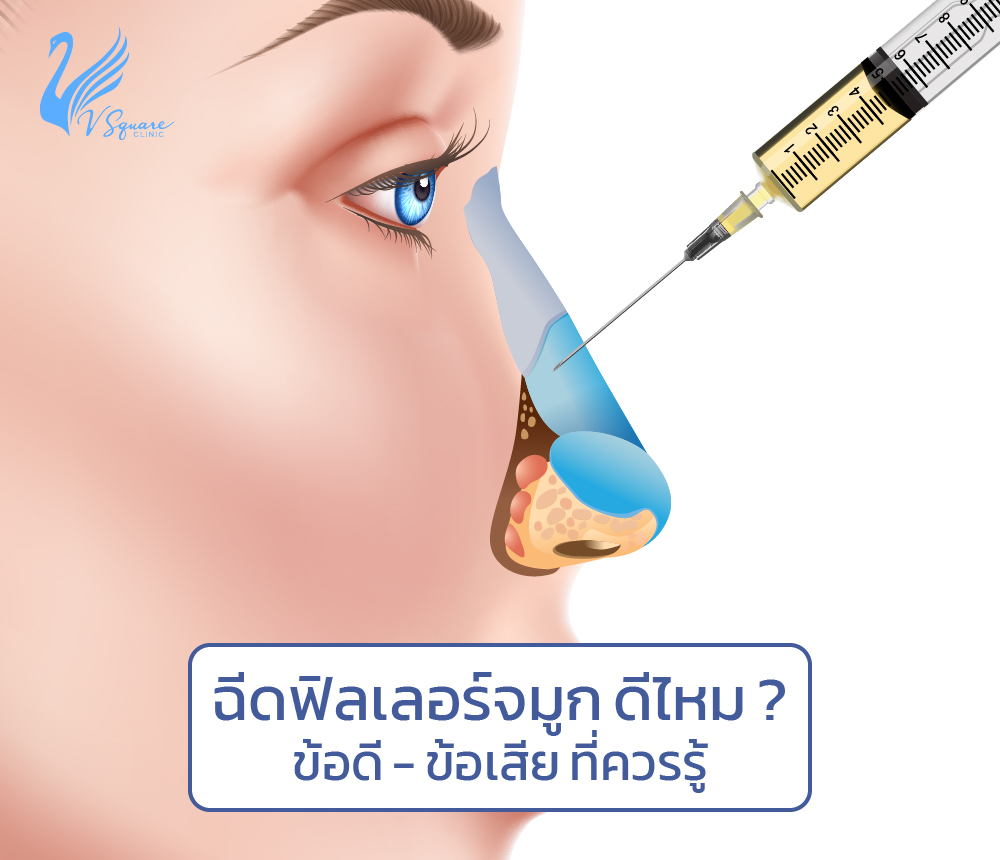 ฟิลเลอร์จมูก