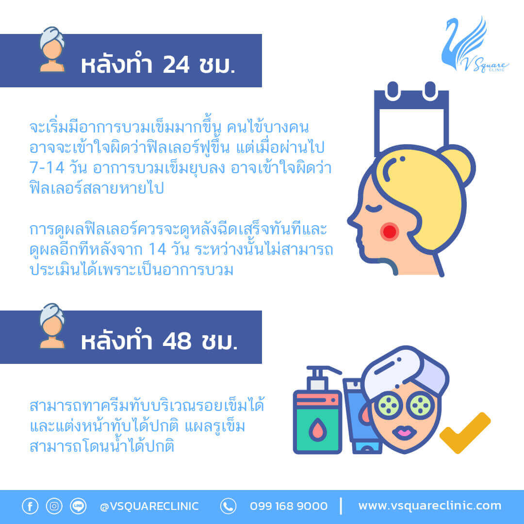 การดูแลหลังฉีดฟิลเลอร์