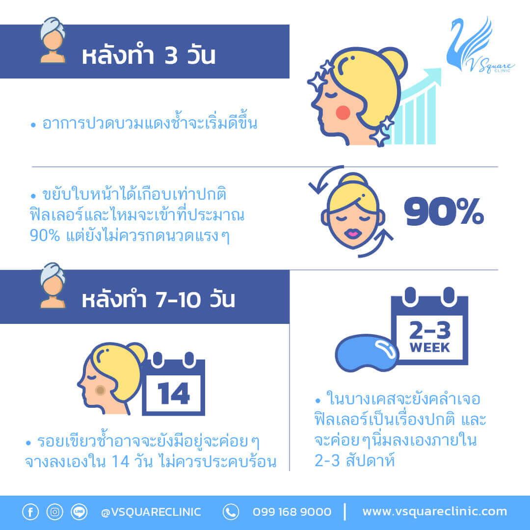 การดูแลหลังฉีดฟิลเลอร์