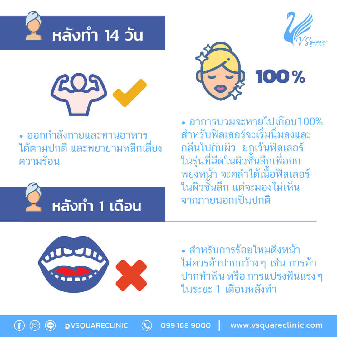 การดูแลหลังฉีดฟิลเลอร์