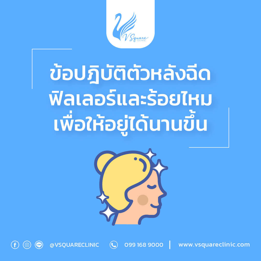 การดูแลหลังฉีดฟิลเลอร์
