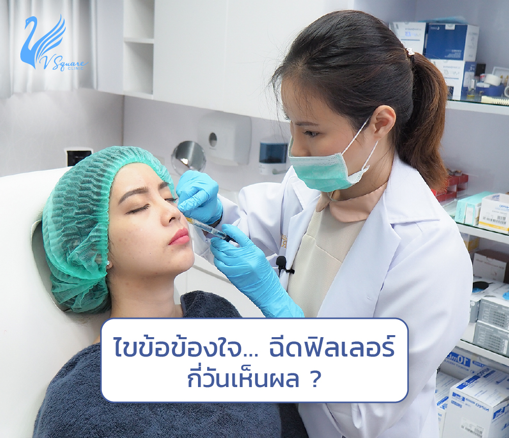 ฉีดฟิลเลอร์กี่วันเห็นผล