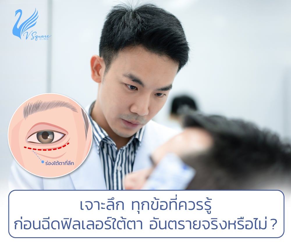 เจาะลึก ข้อควรรู้ก่อนฉีดฟิลเลอร์ใต้ตา หมอชิน