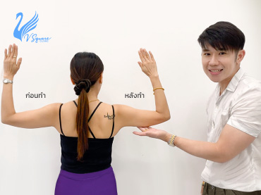 CoolSculpting รีวิว