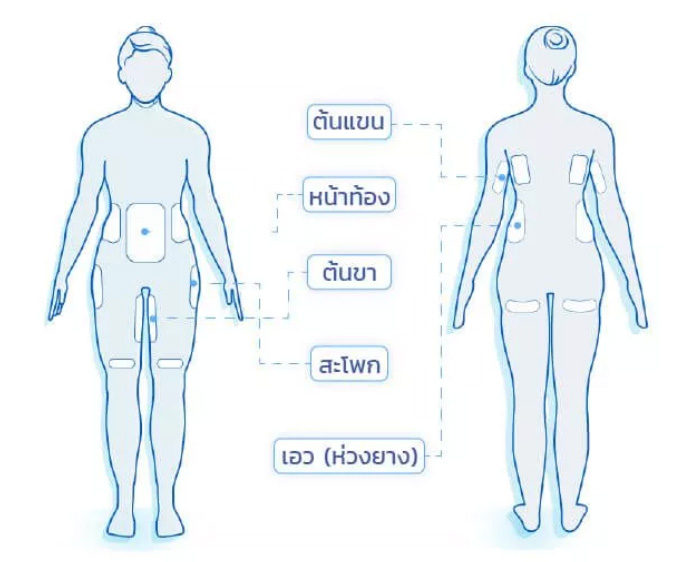 Coolsculpting รีวิว สลายไขมันส่วนเกินด้วยความเย็น เห็นผลเร็ว สบาย ไม่เจ็บตัว Coolsculpting รีวิว สลายไขมันส่วนเกินด้วยความเย็น เห็นผลเร็ว สบาย ไม่เจ็บตัว