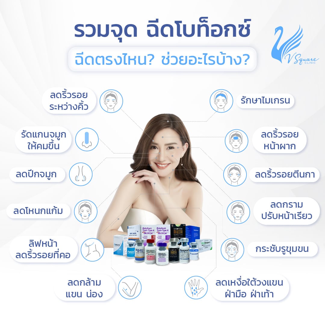 จุดที่นิยมฉีดโบท็อก