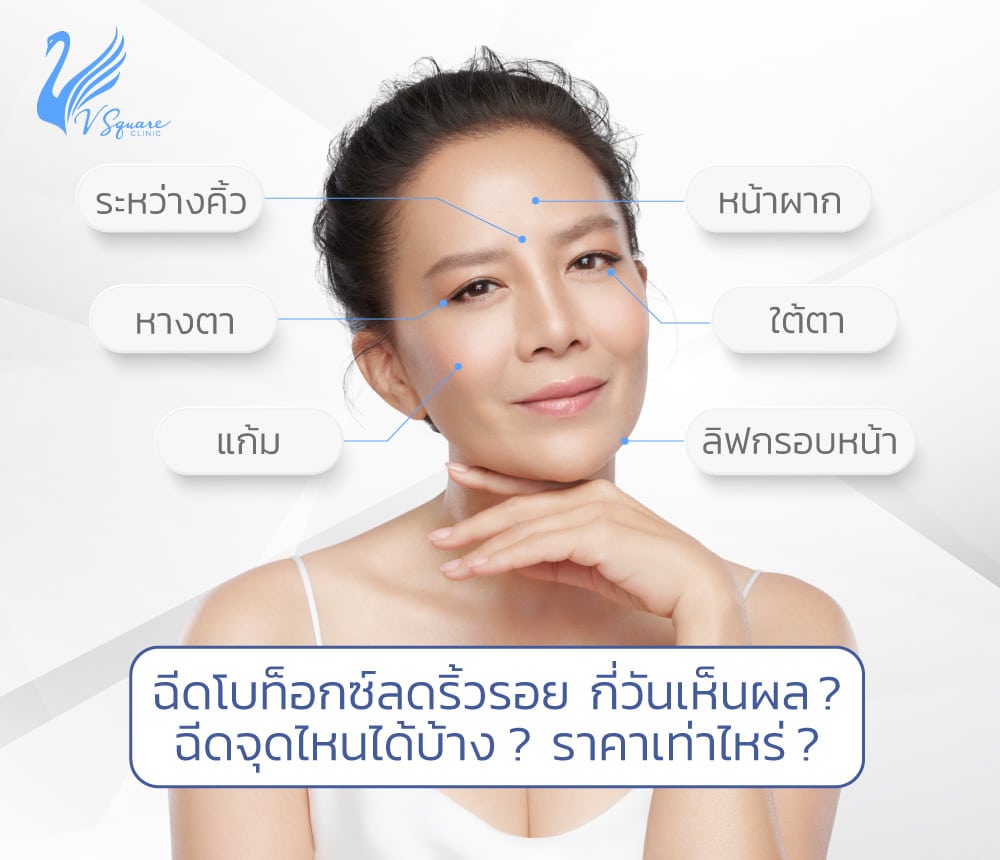 ฉีดโบลดริ้วรอย-กี่วันเห็นผล พี่ต่าย