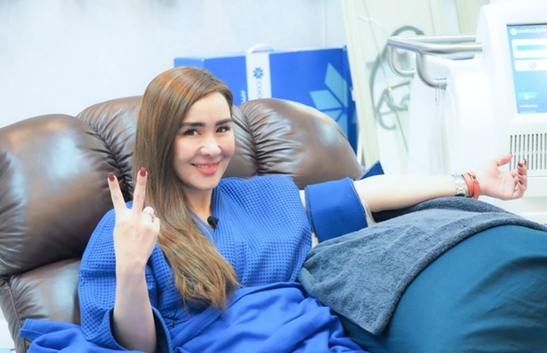 รีวิว-CoolSculpting