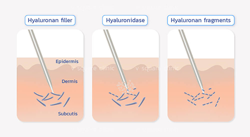 หลักการทำงานของ-hyaluronidase