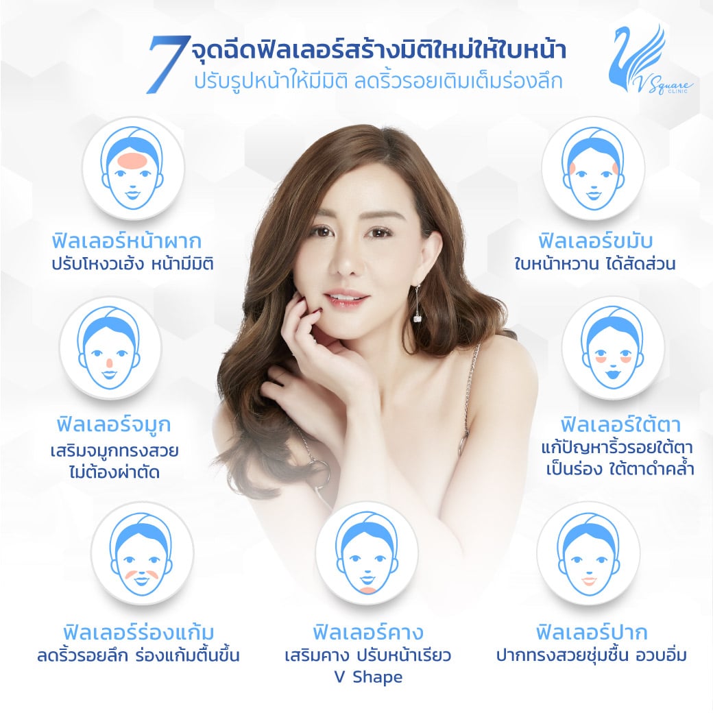 จุดที่นิยมฉีดฟิลเลอร์