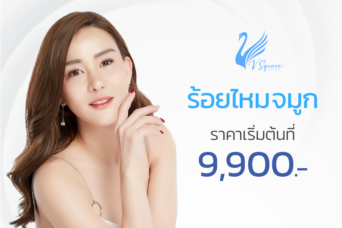 ร้อยไหมจมูก_ราคาเท่าไร