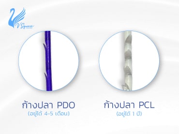 banner-web-ร้อยไหมก้างปลาคืออะไร-อยู่ได้นานแค่ไหน370x277