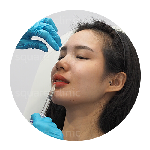 ฉีดฟิลเลอร์ปาก