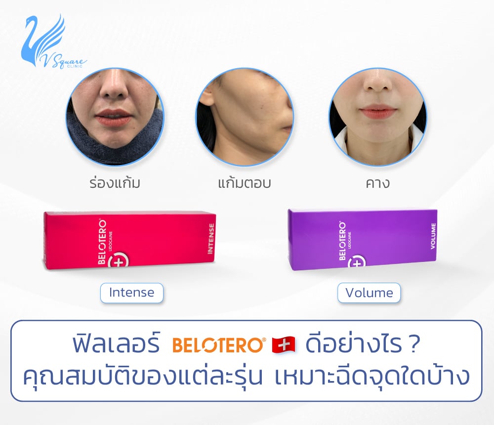 ฟิลเลอร์belotero ดีอย่างไร