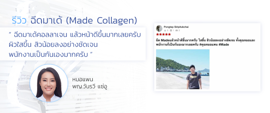 รีวิวฉีดเมโส