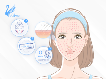 รูปปกบทความ_เรื่องต้องรู้-ฉีดเมโสหน้าใสอันตรายไหม-370x277