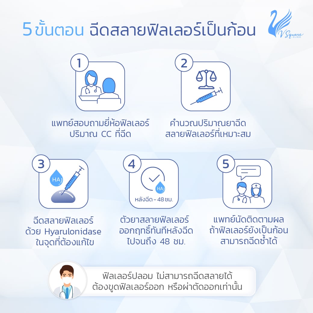 ขั้นตอนฉีดสลายฟิลเลอร์