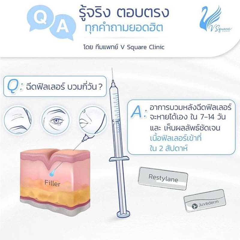 ฉีดฟิลเลอร์ บวมกี่วัน