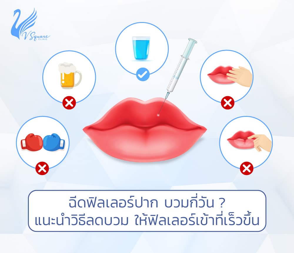 ฉีดฟิลเลอร์ปาก บวม เป็นก้อน