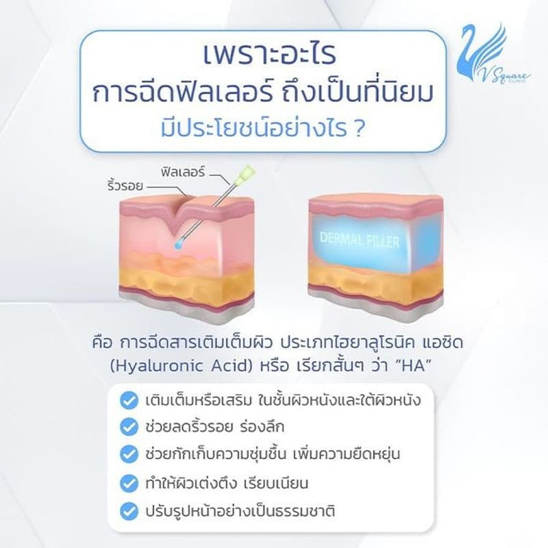 ประโยชน์ของการฉีดฟิลเลอร์