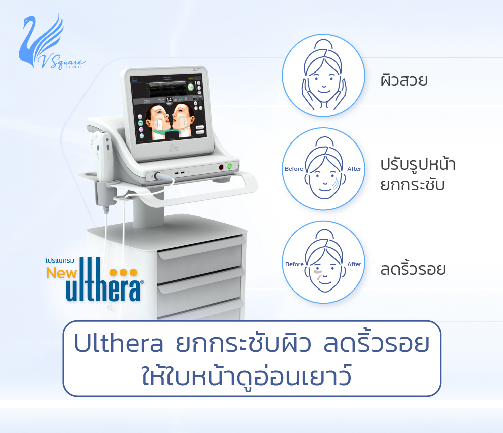 กระชับUltheraยกกระชับลิดริ้วรอย