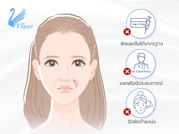 ฉีดฟิลเลอร์ร่องแก้มแล้วเป็นก้อน