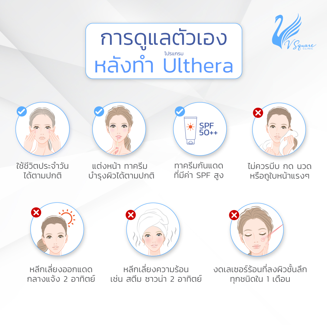 หลังทำ-ulthera