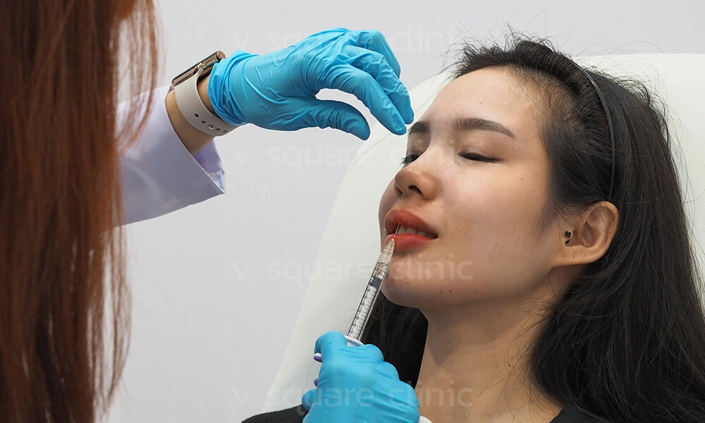 การฉีดฟิลเลอร์ปาก