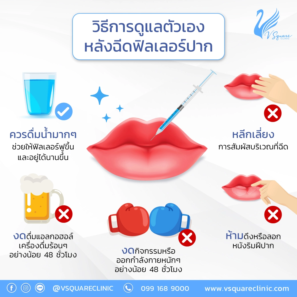 ข้อห้ามหลังฉีดฟิลเลอร์ปาก