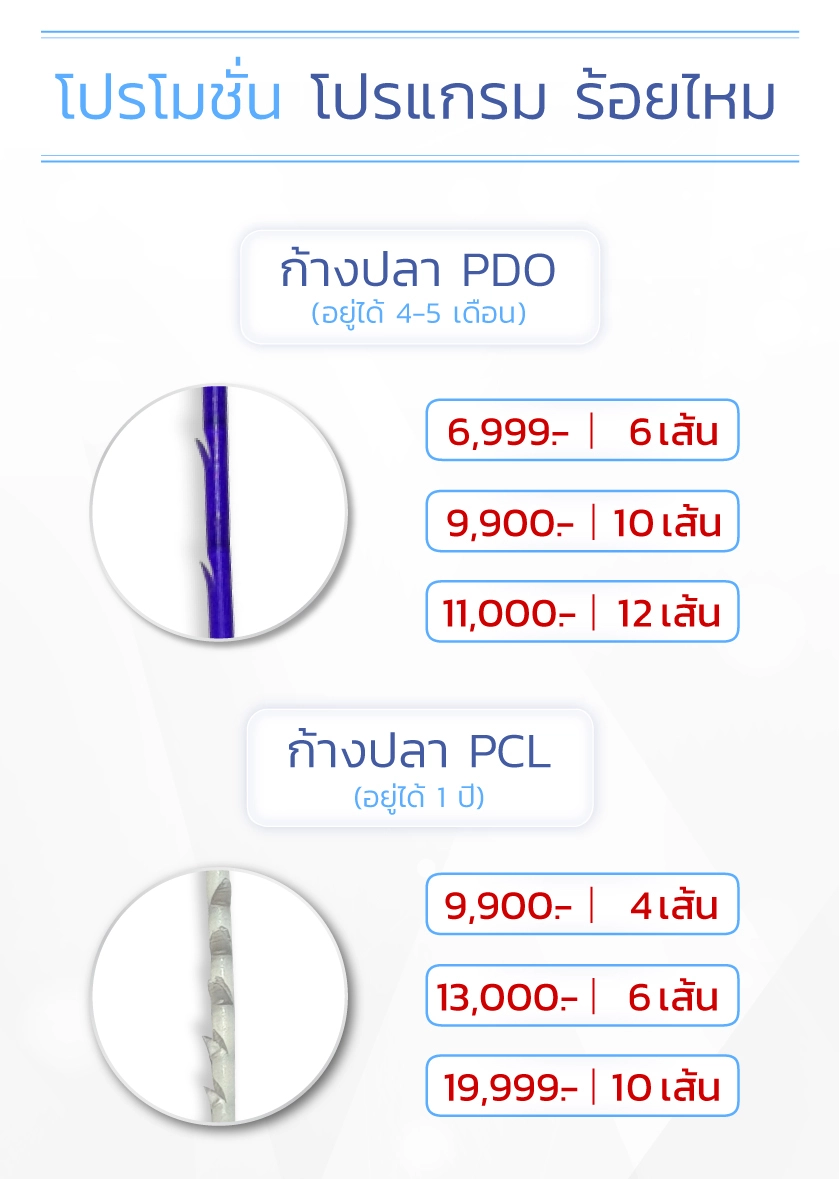 ร้อยไหม ราคา