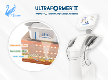 โปรแกรม Ultra Hifu ผลข้างเคียง__370X277