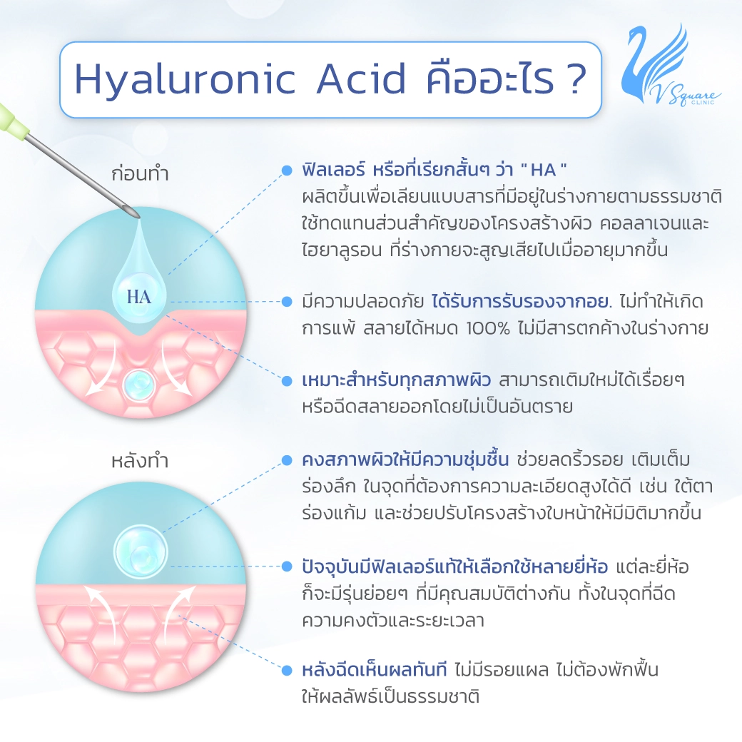 ไฮยาลูโรนิค แอซิด (Hyaluronic Acid)
