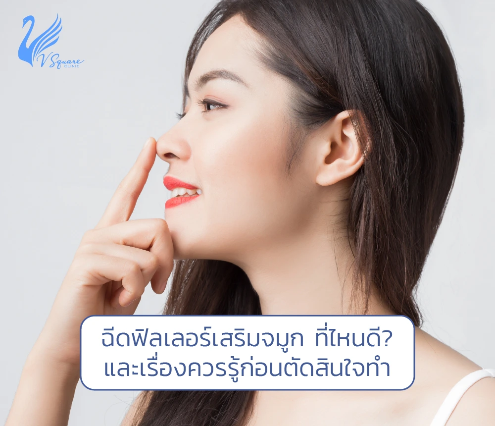 ฉีดฟิลเลอร์จมูกที่ไหนดีที่สุด ? ปรับสันจมูก ได้ทรงสวย ปลอดภัย ก่อนฉีดต้องรู้