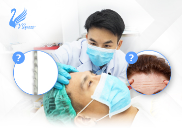 ร้อยไหมหน้าผาก มีผลข้างเคียงอย่างไร_370x277