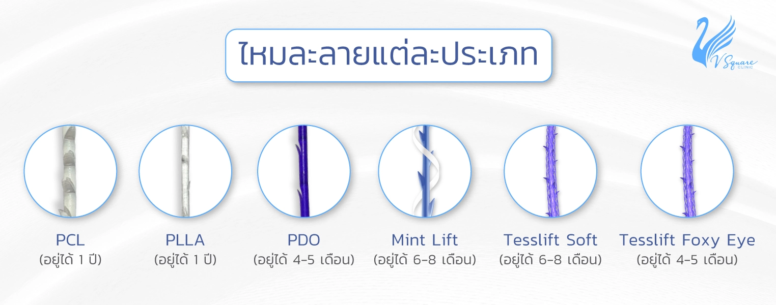ลักษณะของเส้นไหมที่ใช้ในการร้อยไหม