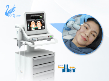 Ulthera-ยกกระชับรอบดวงตา