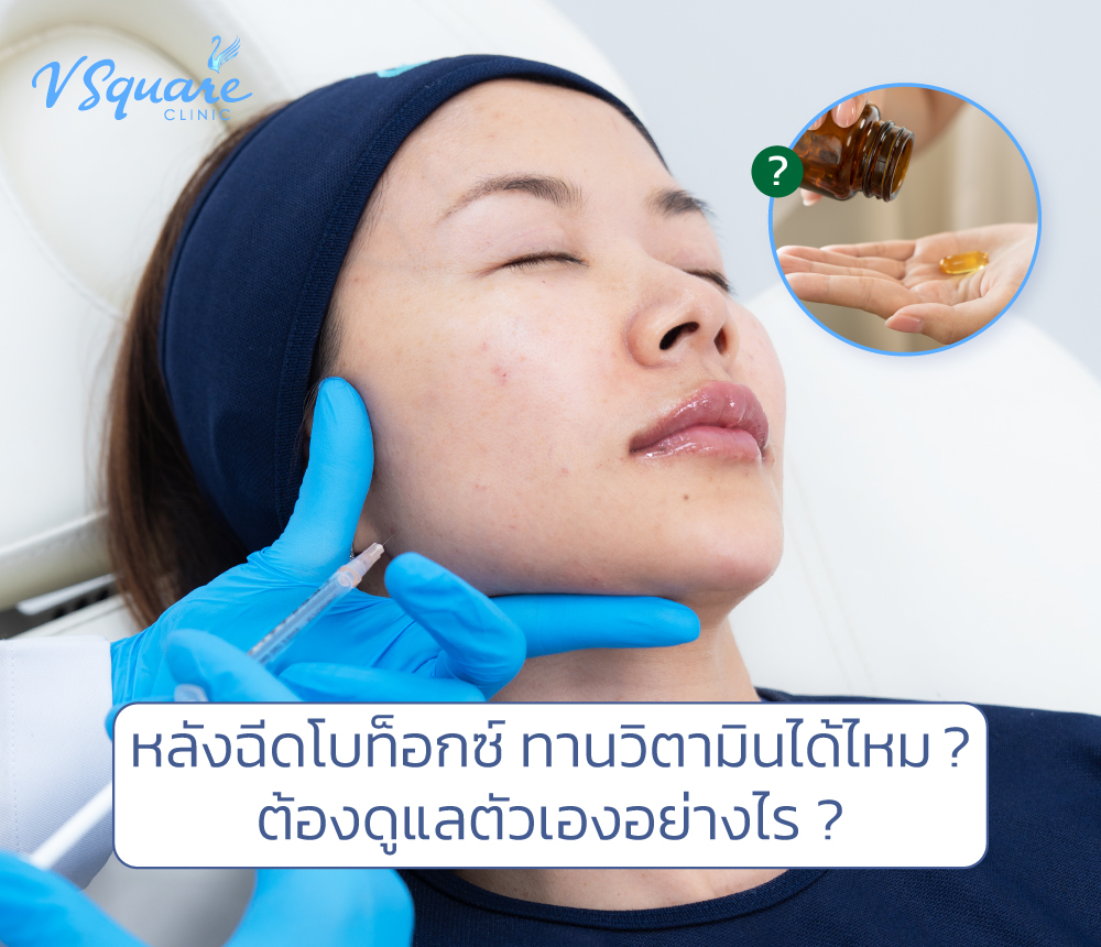 รูปบทความ_หลังฉีดโบท็อกซ์ทานวิตามินได้ไหม