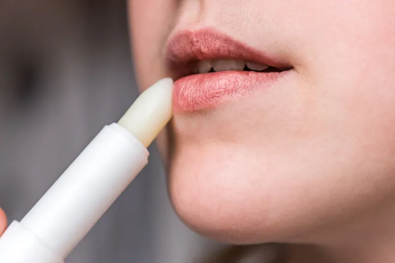 Causes of dry lips