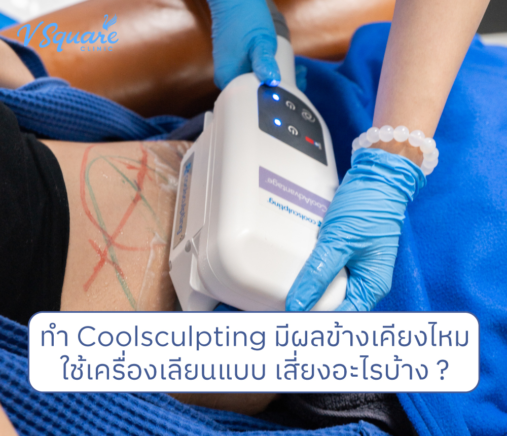 ทำ-Coolsculpting-มีผลข้างเคียงไหม