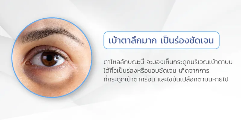 ลักษณะตาโหล-1