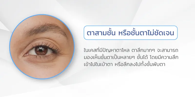 ลักษณะตาโหล-2